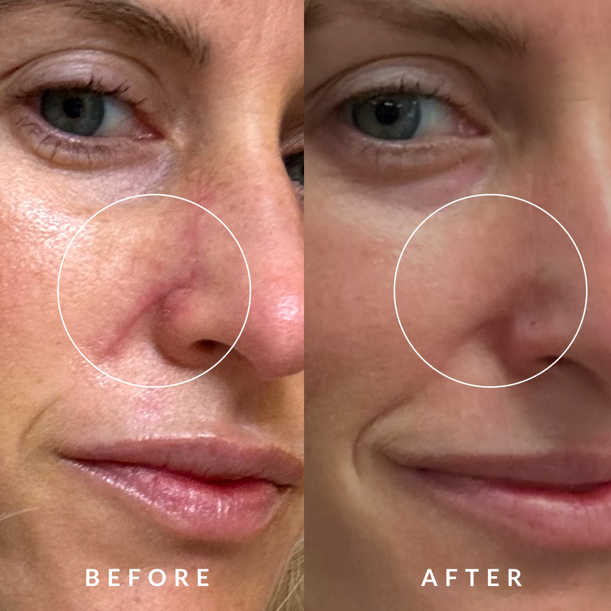 Healing and Fading Marks Effectively