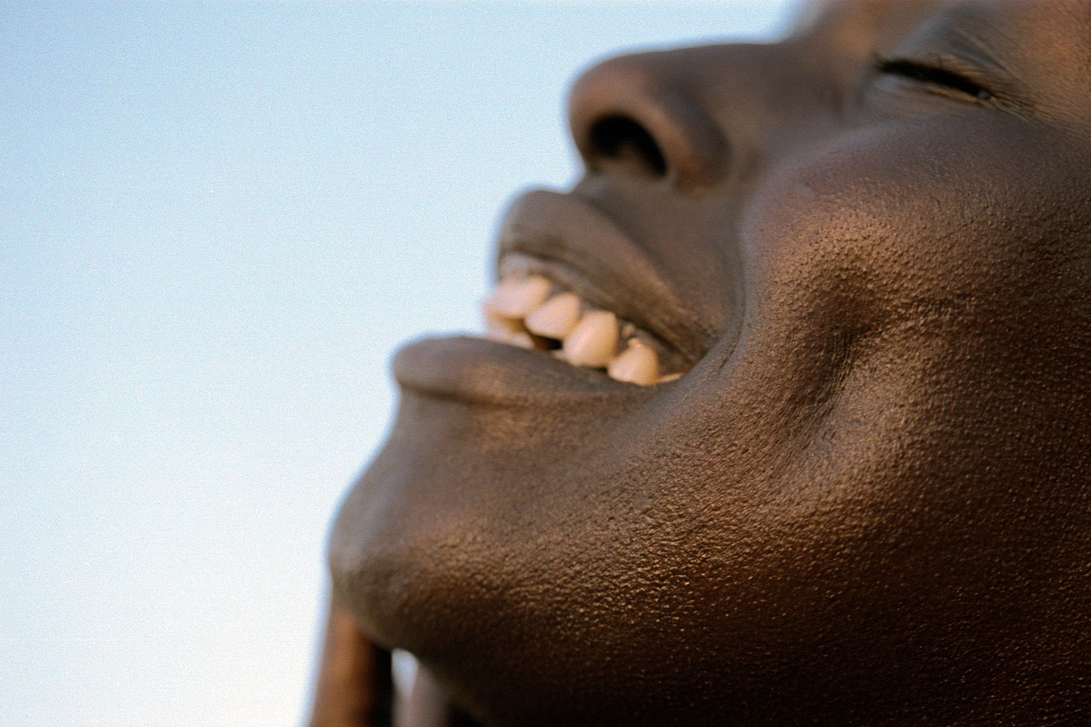 Strengthen Your Skin Barrier